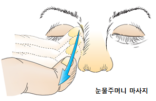 눈물주머니 마사지 방법